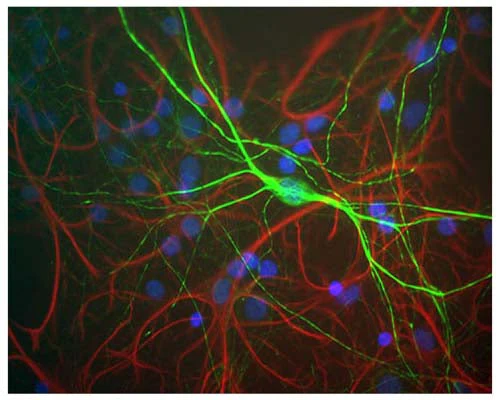 Anti-Neurofilament Heavy, phosphorylated and non-phosphorylated (pNF-H) Antibody