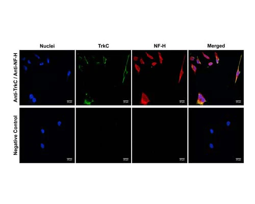 Anti-Neurofilament Heavy, phosphorylated and non-phosphorylated (pNF-H) Antibody - Image 2