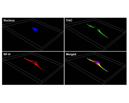 Anti-Neurofilament Heavy, phosphorylated and non-phosphorylated (pNF-H) Antibody - Image 3