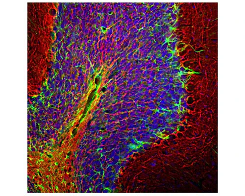 Anti-Neurofilament heavy polypeptide, phosphorylated, (pNF-H) Antibody
