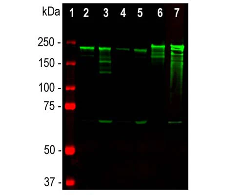 Anti-Neurofilament heavy polypeptide, phosphorylated, (pNF-H) Antibody (NAP4) - Image 3