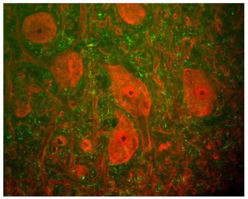 Anti-Neurofilament heavy polypeptide, phosphorylated, (pNF-H) Antibody