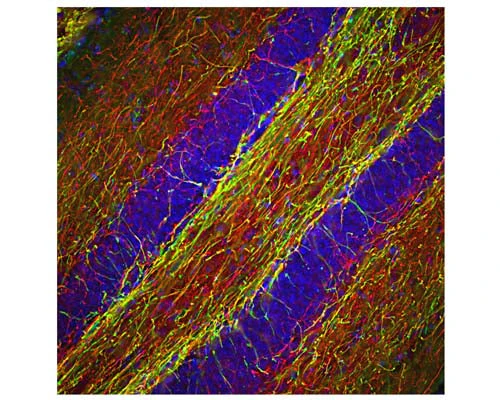 Anti-Neurofilament heavy polypeptide, phosphorylated, (pNF-H) Antibody - Image 2