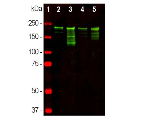 Anti-Neurofilament heavy polypeptide, phosphorylated, (pNF-H) Antibody - Image 3