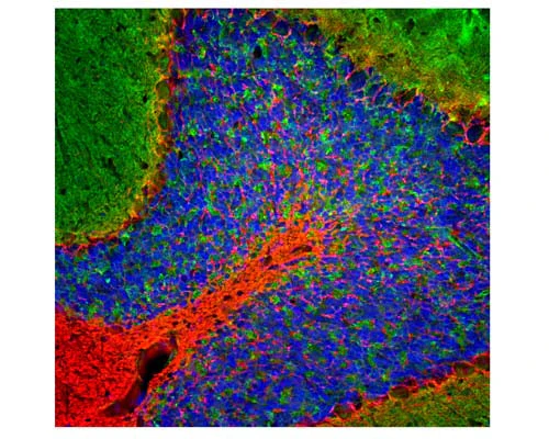 Anti-Neurofilament light polypeptide, C-terminus, (NF-L-Ct) Antibody