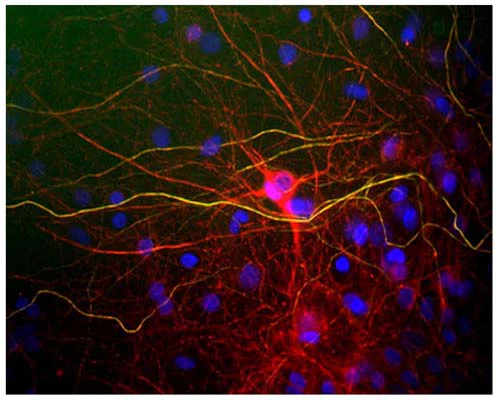 Anti-Neurofilament light polypeptide (NF-L) Antibody