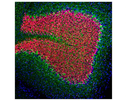 Anti-Neurofilament light polypeptide (NF-L) Antibody - Image 3