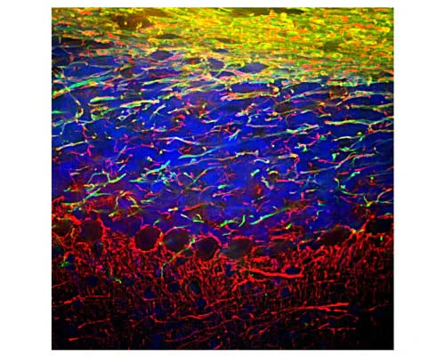 Anti-Neurofilament light polypeptide (NF-L) Antibody