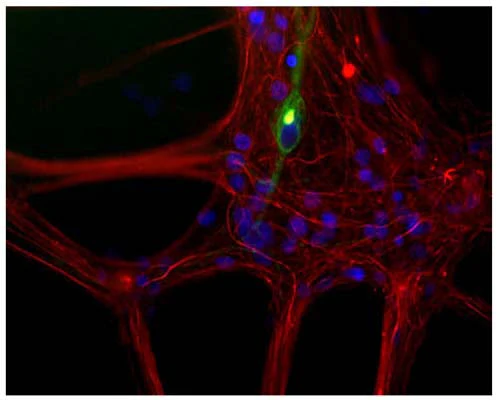 Anti-Neurofilament light polypeptide (NF-L) Antibody - Image 3