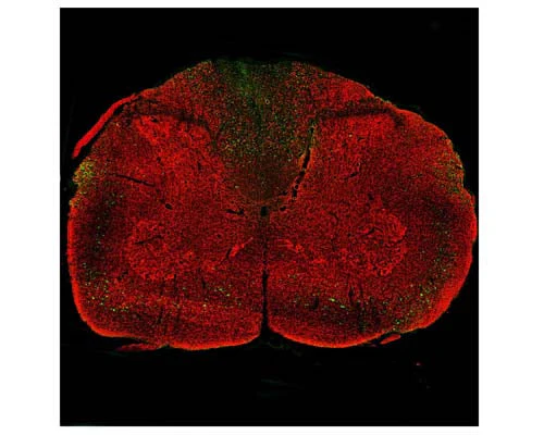 Anti-Neurofilament light polypeptide (NF-L), DG-Sensor™ Antibody (1D44)