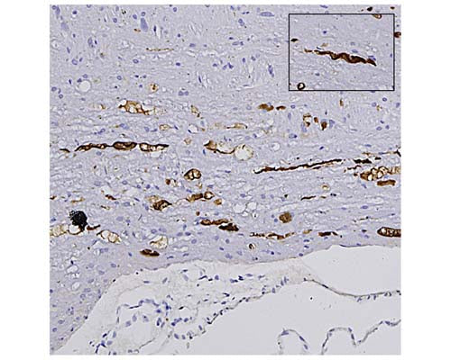 Anti-Neurofilament light polypeptide (NF-L), DG-Sensor™ Antibody (1D44) - Image 2