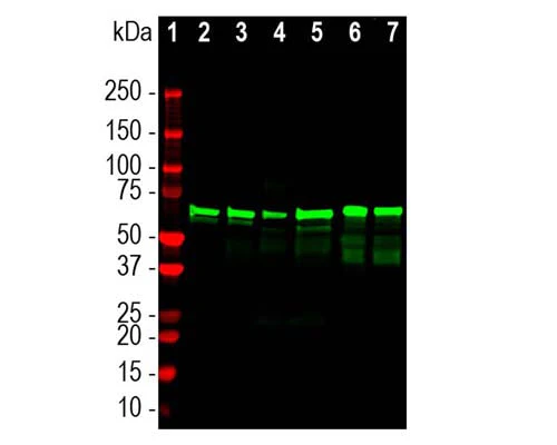 Anti-Neurofilament light polypeptide (NF-L), DG-Sensor™ Antibody (1D44) - Image 3