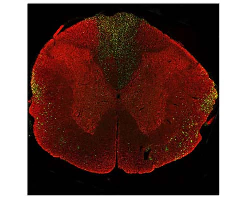 Anti-Neurofilament light polypeptide (NF-L), DG-Sensor™ Antibody (6H63)