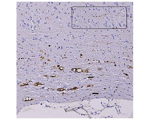 Anti-Neurofilament light polypeptide (NF-L), DG-Sensor™ Antibody (6H63) - Image 2
