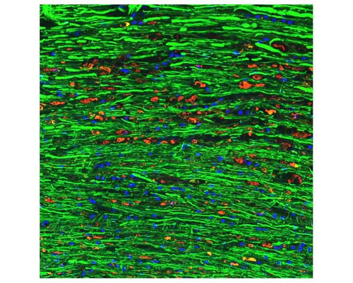 Anti-Neurofilament light polypeptide (NF-L), DG-Sensor™ Antibody