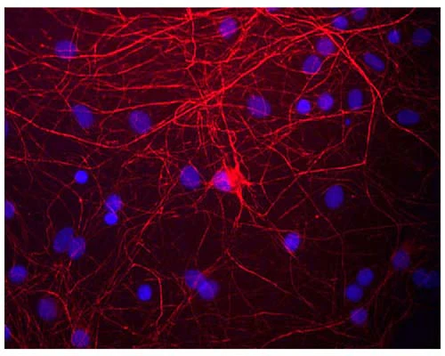 Anti-Neurofilament medium polypeptide (NF-M) Antibody