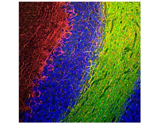 Anti-Neurofilament medium polypeptide (NF-M) Antibody - Image 2