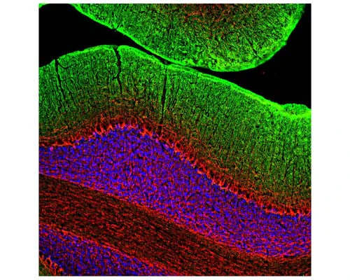 Anti-Neurofilament medium polypeptide (NF-M) Antibody