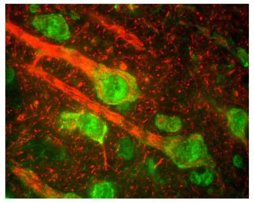 Anti-Neurofilament medium polypeptide (NF-M) Antibody - Image 2