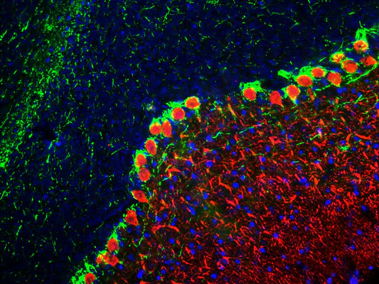 Anti-Neurofilament NF-H Antibody - Image 3