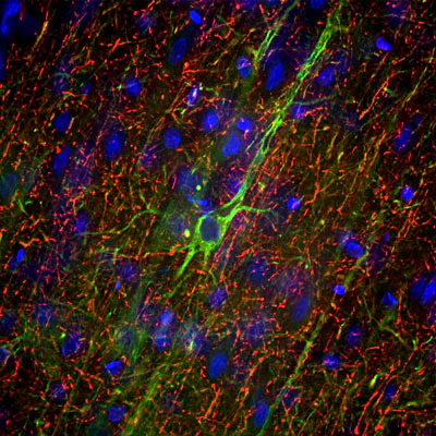 Anti-Neurofilament NF-H Antibody - Image 5