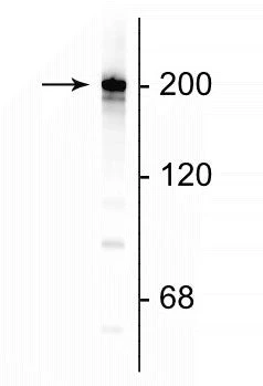 Anti-Neurofilament NF-H Antibody