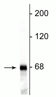 Anti-Neurofilament NF-L Antibody