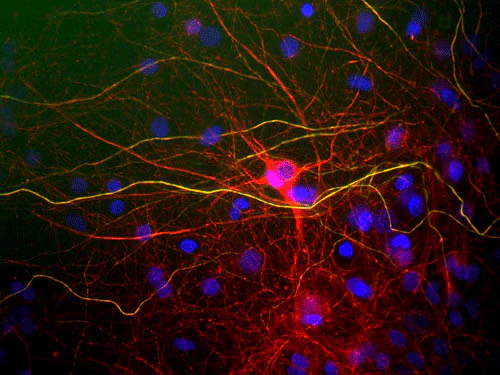Anti-Neurofilament NF-L Antibody - Image 3