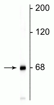 Anti-Neurofilament NF-L Antibody
