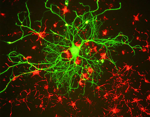 Anti-Neurofilament NF-L Antibody - Image 2