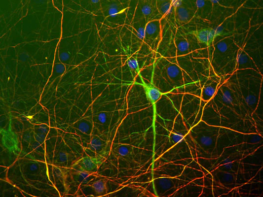 Anti-Neurofilament NF-L Antibody - Image 3