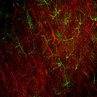 Anti-Neurofilament NF-L Antibody - Image 4