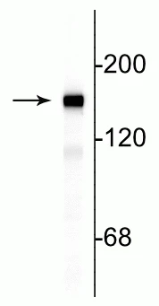Anti-Neurofilament NF-M Antibody