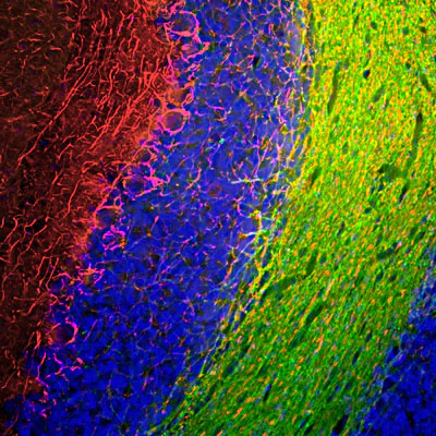 Anti-Neurofilament NF-M Antibody - Image 2