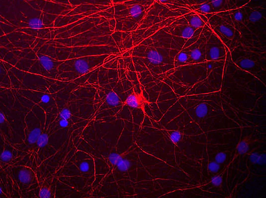 Anti-Neurofilament NF-M Antibody - Image 3