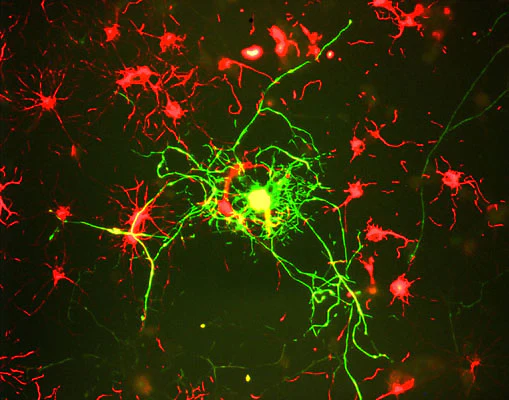 Anti-Neurofilament NF-M Antibody - Image 3