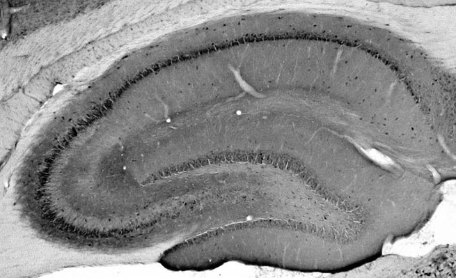 Anti-Neuroligin-1 Antibody - Image 2
