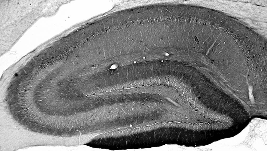 Anti-Neuroligin-3 Antibody - Image 2
