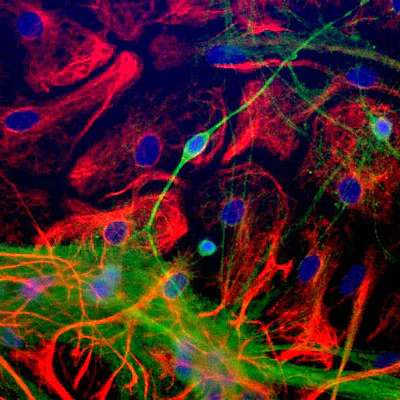 Anti-Neuron-Specific Enolase (NSE) Type 2 Antibody