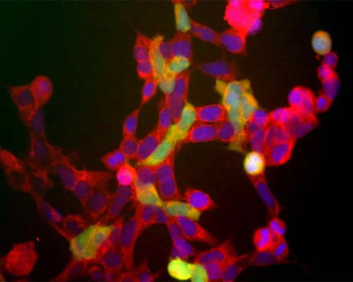 Anti-Neuron specific enolase (NSE) Antibody