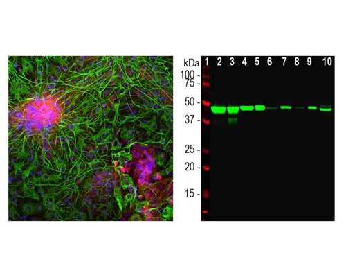 Anti-Neuron specific enolase (NSE) Antibody - Image 2