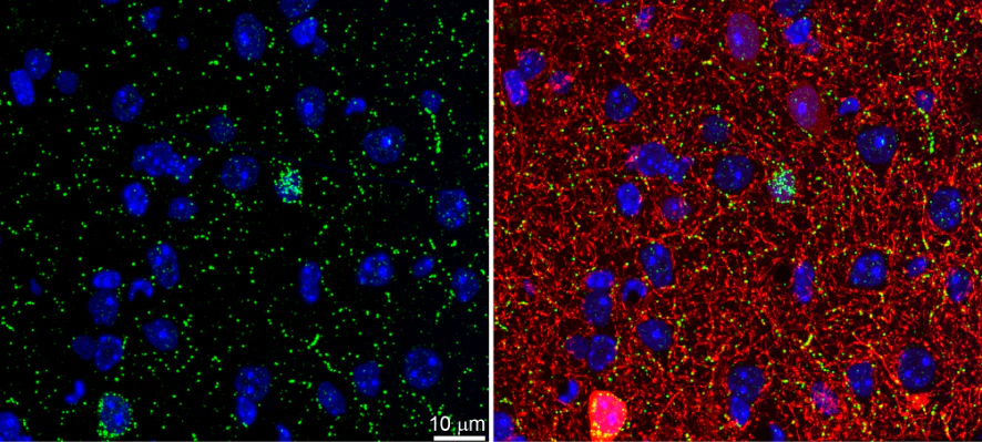 Anti-Neuropeptide Y Antibody