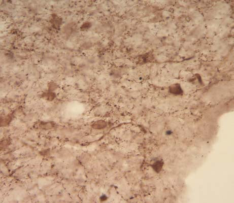 Anti-Neuropeptide Y (NPY) Antibody - Image 2