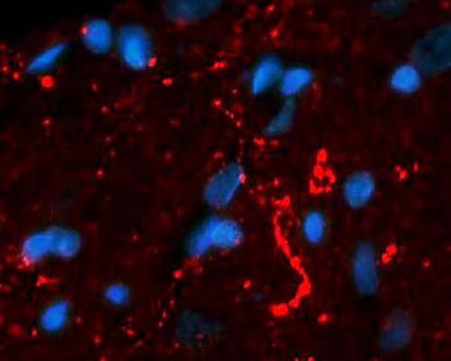 Anti-Neurotensin (NT) Antibody