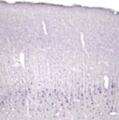 Anti-Neurotrophin-4/5 (NT-4/5) Antibody