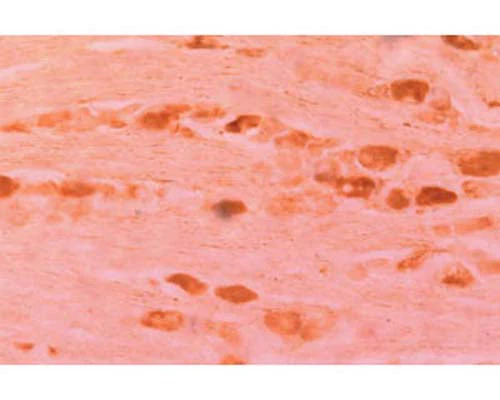 Anti-Neurturin (NTN) Antibody