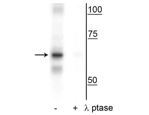 Anti-NF-kB p65 (Ser316) Antibody