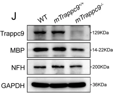 Anti-NFH (Neurofilament Heavy Chain) Antibody - Image 11