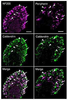 Anti-NFH (Neurofilament Heavy Chain) Antibody - Image 2