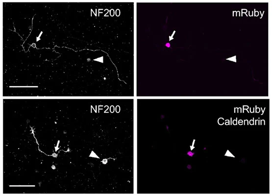 Anti-NFH (Neurofilament Heavy Chain) Antibody - Image 3